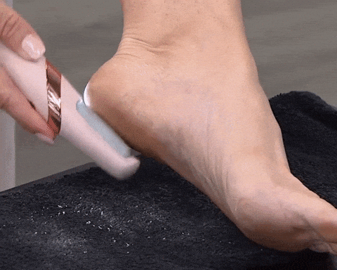 REMOVEDOR DE CALLOS ELÉCTRICO